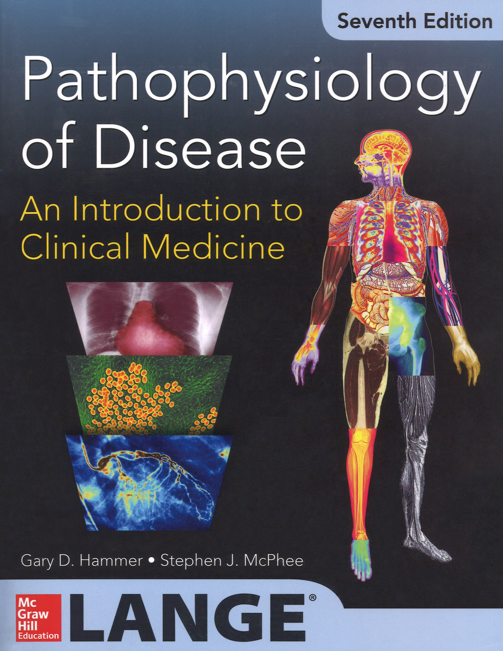 Pathophysiology of disease: an introduction to clinical medicine