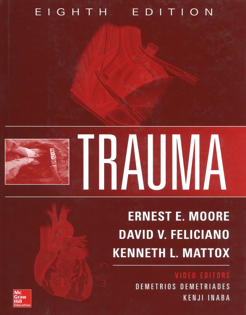 Trauma