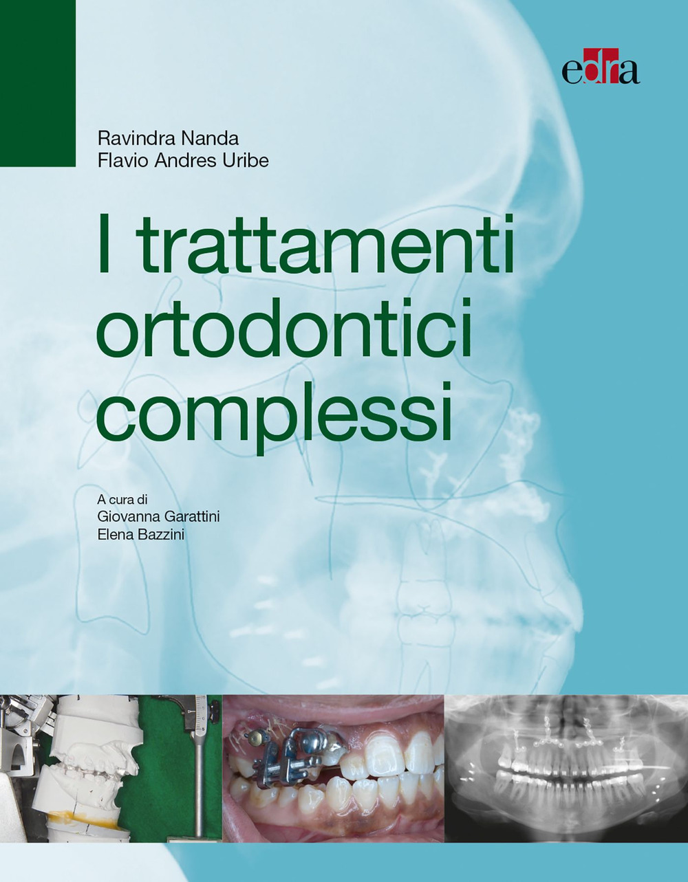 I trattamenti ortodontici complessi