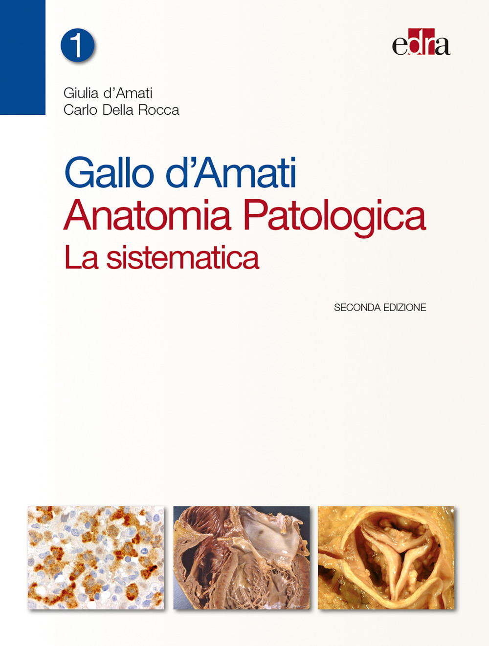 Gallo d'Amati. Anatomia patologica. La sistematica