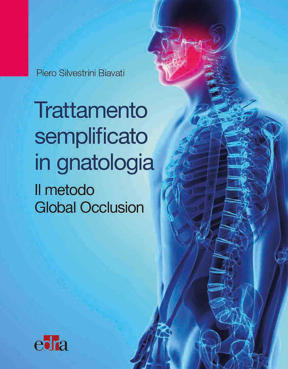 Trattamento semplificato in gnatologia. Il metodo Global Occlusion