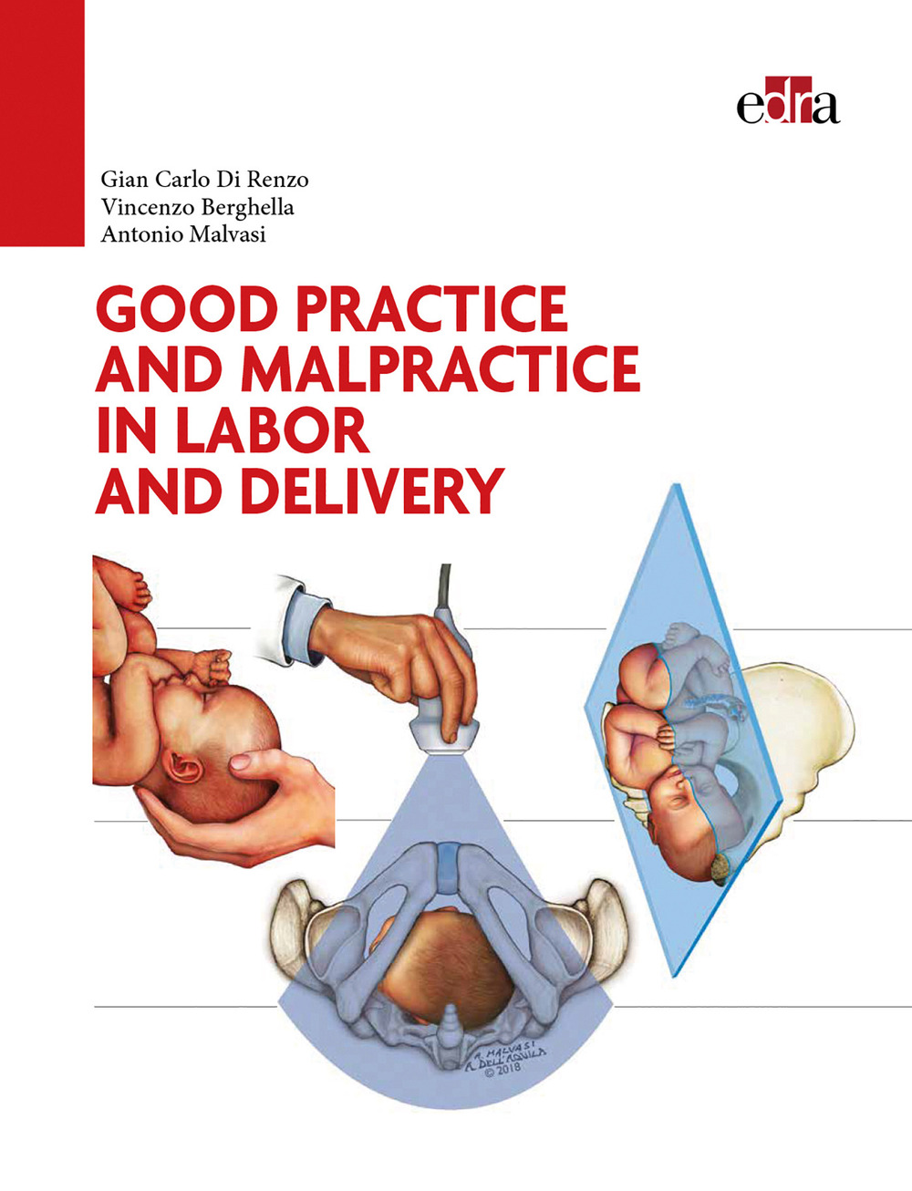 Good practice and malpractice in labor and delivery