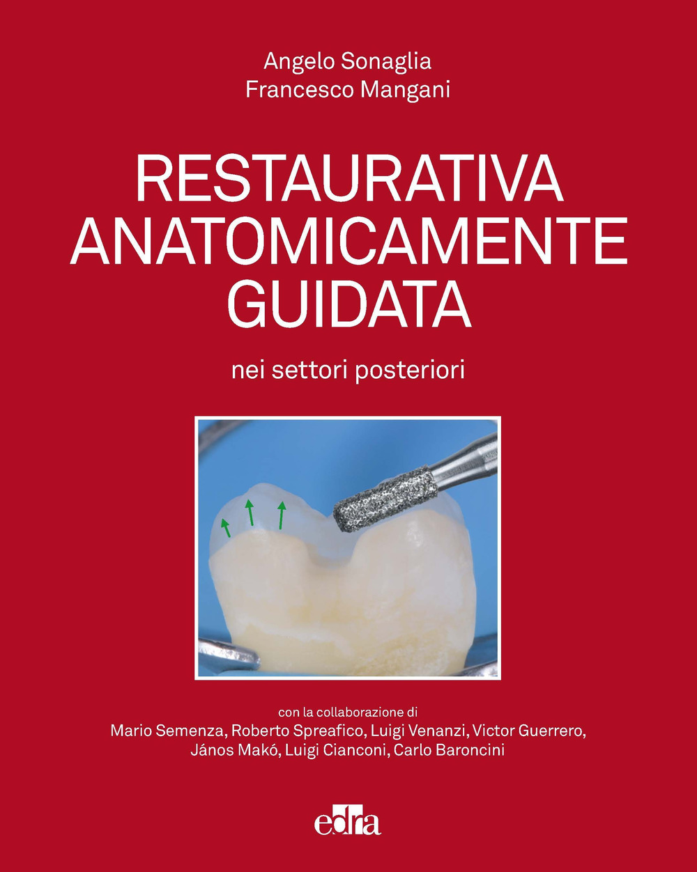 Restaurativa anatomicamente guidata nei settori posteriori