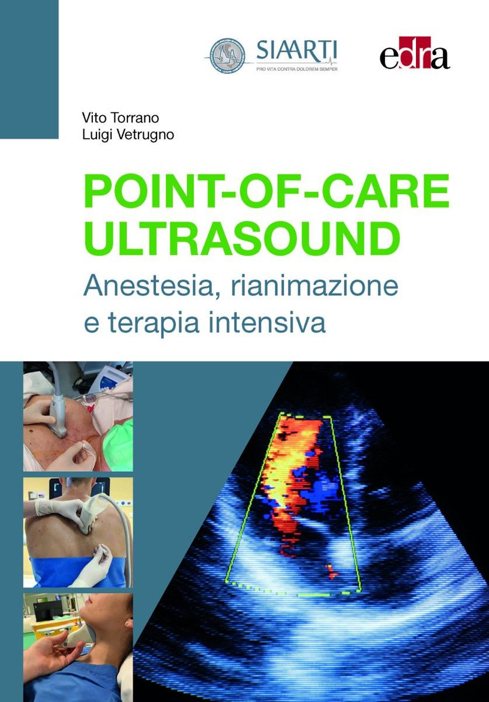 Point-of-Care Ultrasound. Anestesia, rianimazione e terapia intensiva