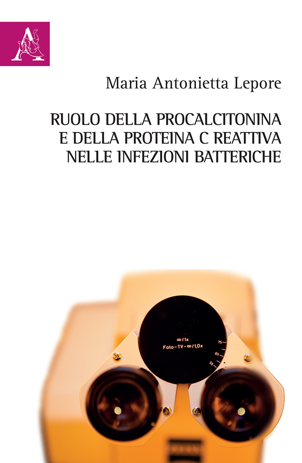 Ruolo della procalcitonina e della proteina C reattiva nelle infezioni batteriche