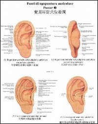 Tavole di punti di agopuntura auricolare