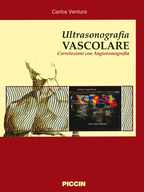 Ultrasonografia vascolare. Correlazioni con angiotomografia