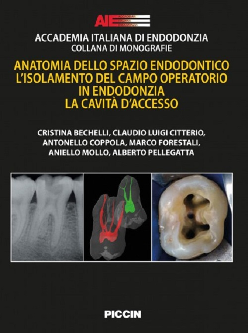 Anatomia dello spazio endodontico. L'isolamento del campo operatorio in endodonzia. La cavità d'accesso