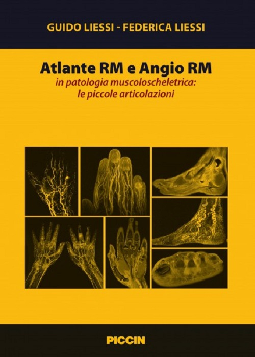 Atlante RM e angio RM in patologia muscoloscheletrica: le piccole articolazioni