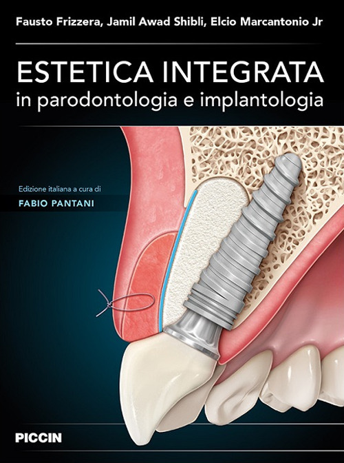 Estetica integrata in parodontologia e implantologia