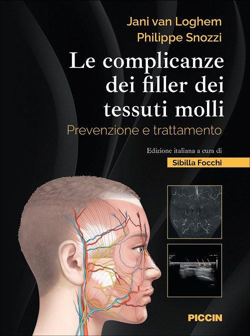 Le complicanze dei filler dei tessuti molli. Prevenzione e trattamento