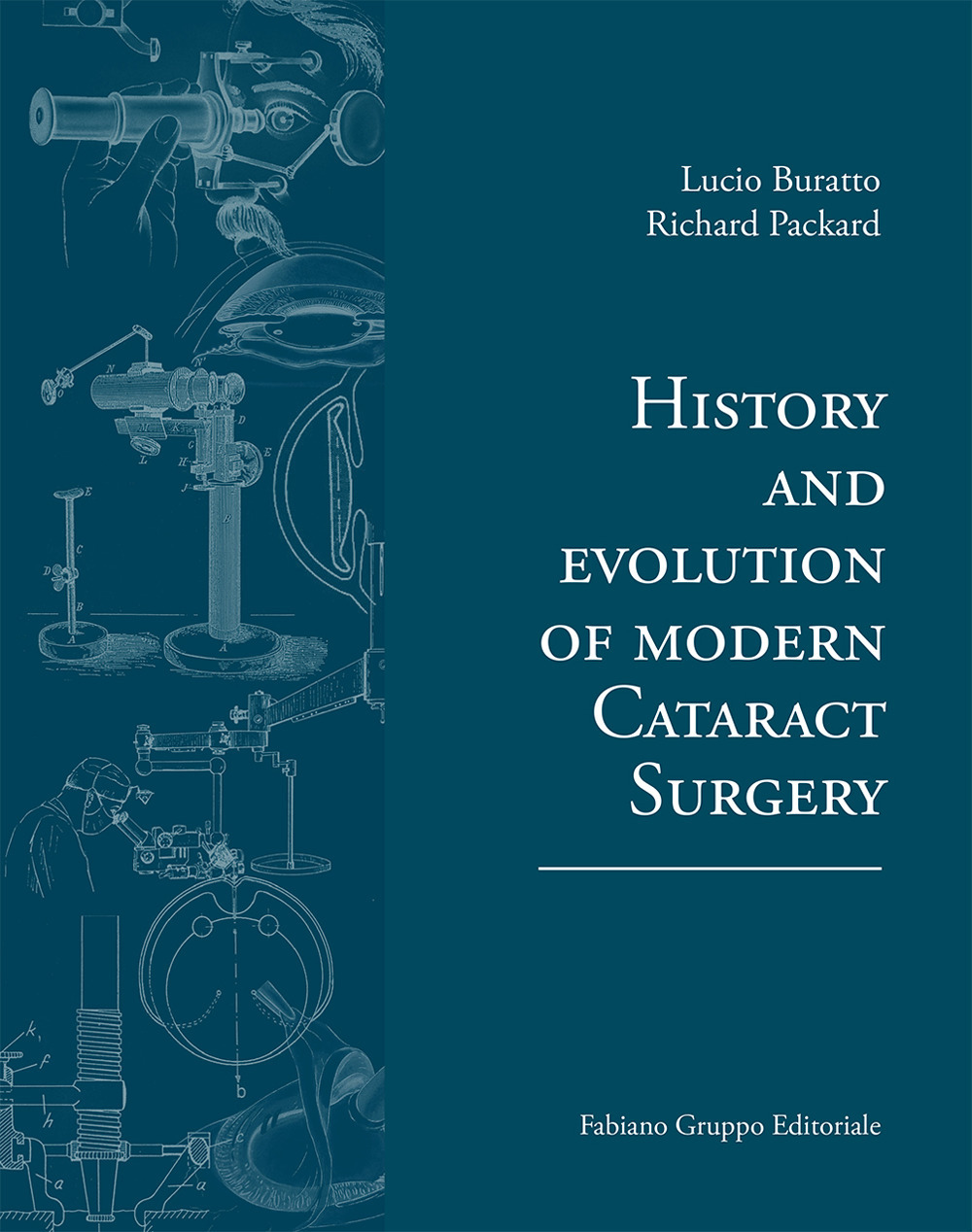 History and evolution of modern cataract surgery