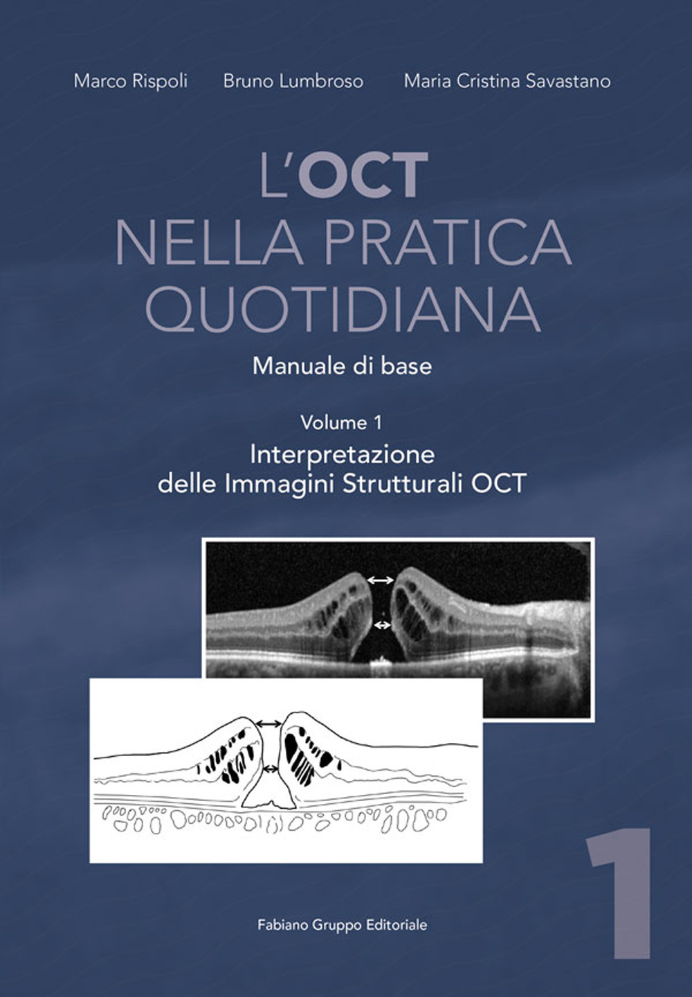 L'OCT nella pratica quotidiana. Manuale di base. Vol. 1: Interpretazione delle Immagini Strutturali OCT