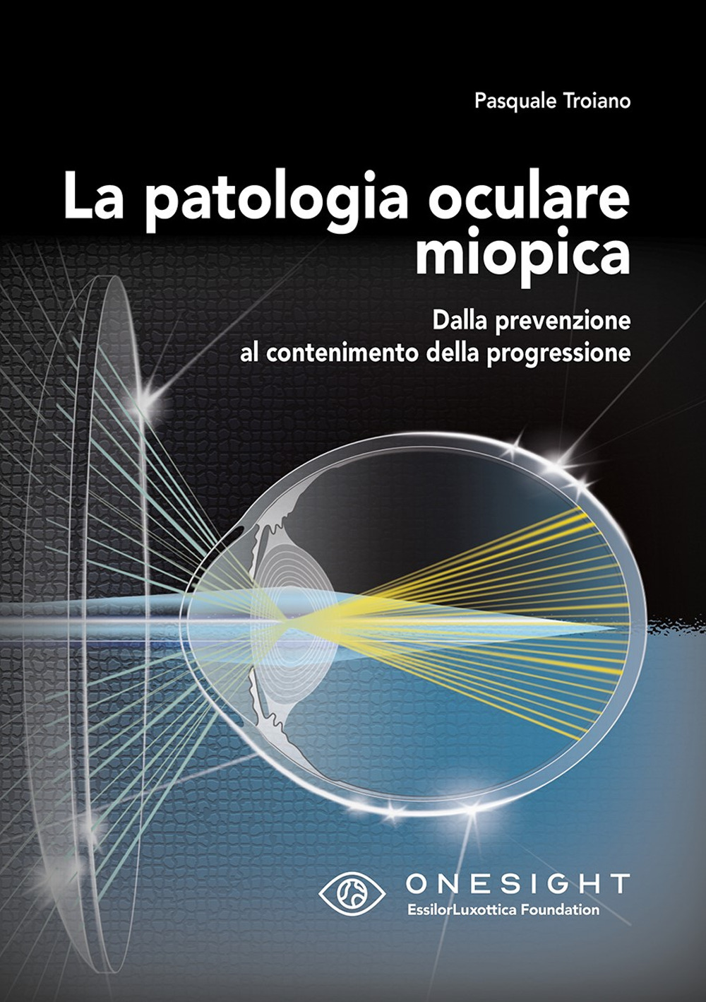 La patologia oculare miopica. Dalla prevenzione al contenimento della progressione. Ediz. per la scuola