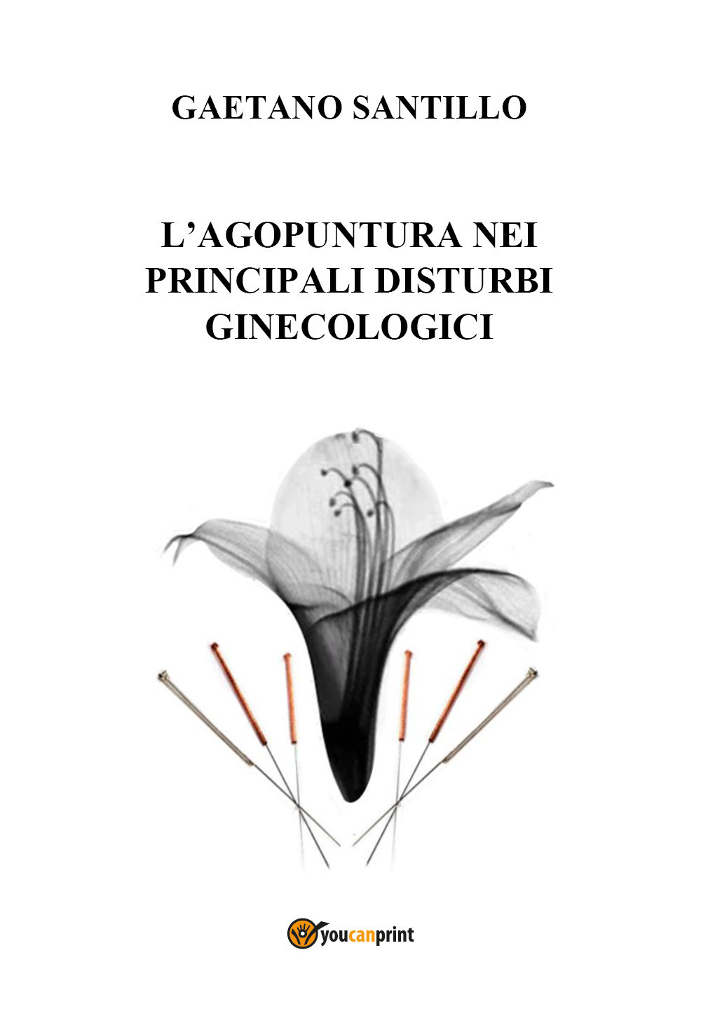 L'agopuntura nei principali disturbi ginecologici