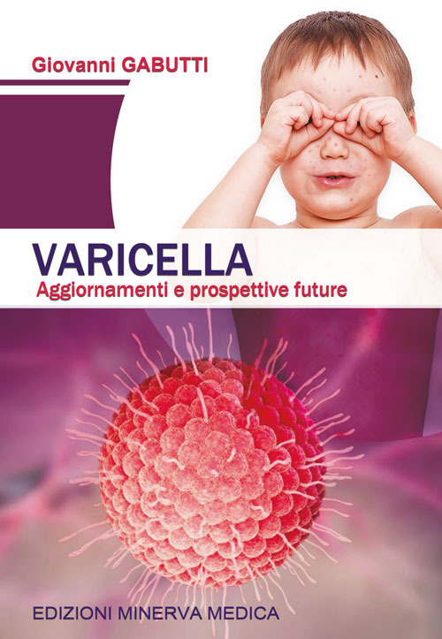 Varicella. Aggiornamenti e prospettive future