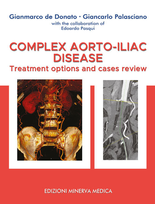 Complex aorto-iliac disease. Treatment options and cases review