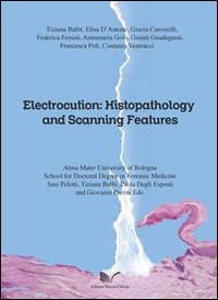 Electrocution. Histopathology and scanning features