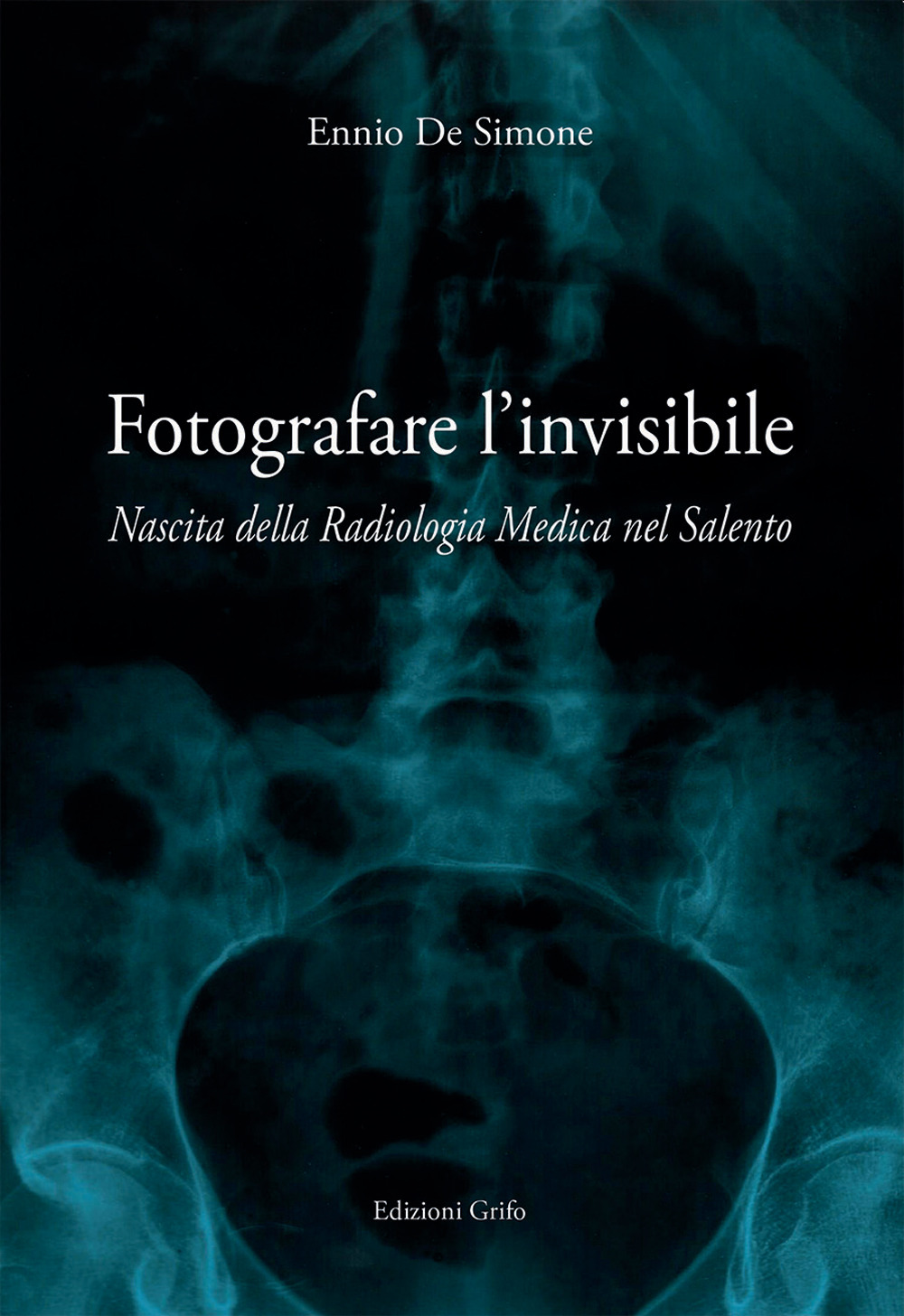 Fotografare l'invisibile. Nascita della radiologia medica nel Salento