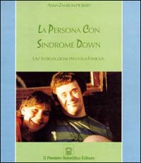 La persona con sindrome Down