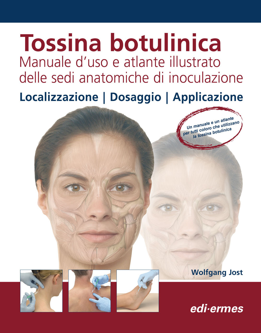 Tossina botulinica. Manuale d'uso e atlante illustrato delle sedi anatomiche di inoculazione