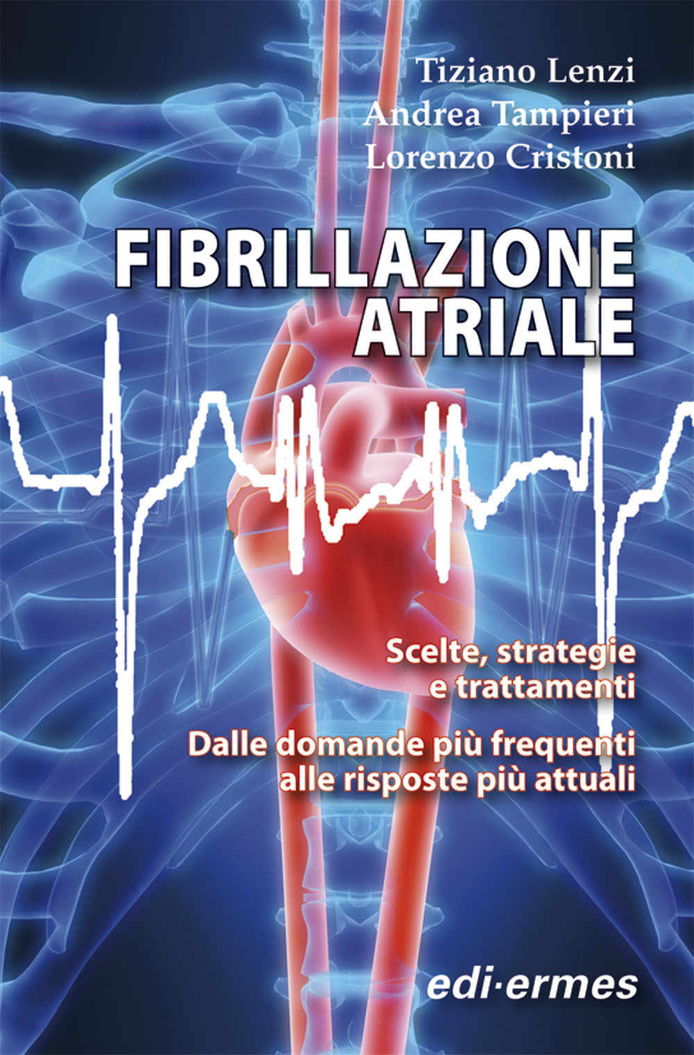 Fibrillazione atriale. Scelte, strategie e trattamenti. Dalle domande più frequenti alle risposte più attuali