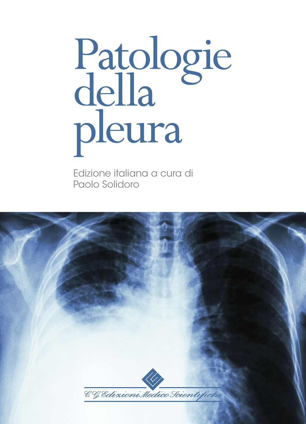 Patologie della pleura