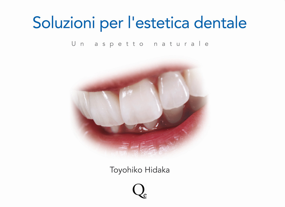 Soluzioni per l'estetica dentale. Un aspetto naturale