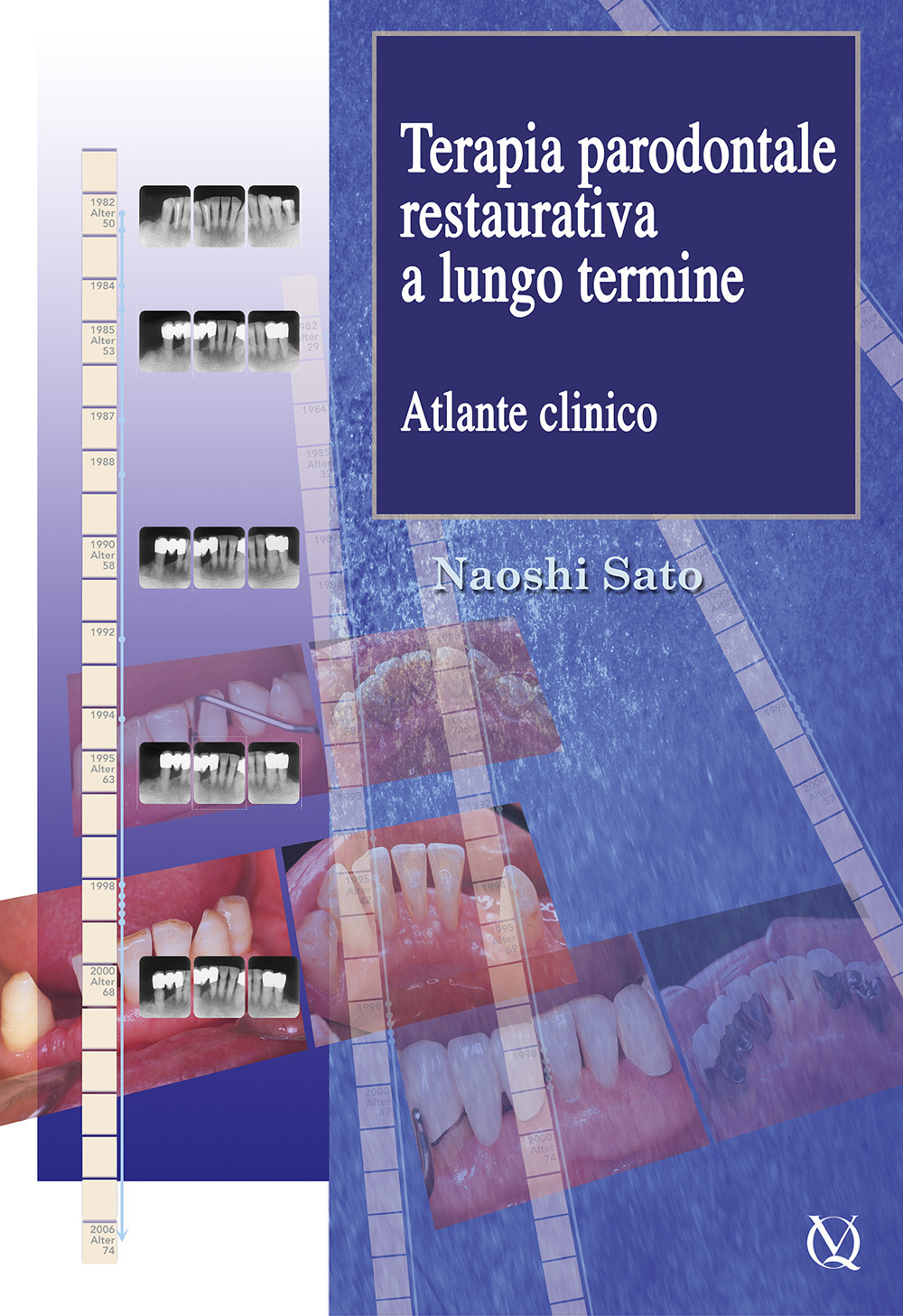 Terapia parodontale restaurativa a lungo termine. Atlante clinico