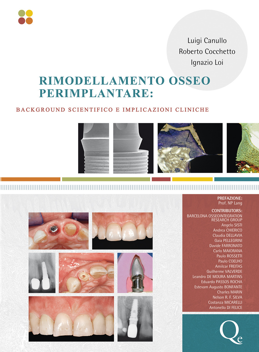 Rimodellamento osseo perimplantare. Background scientifico e implicazioni cliniche