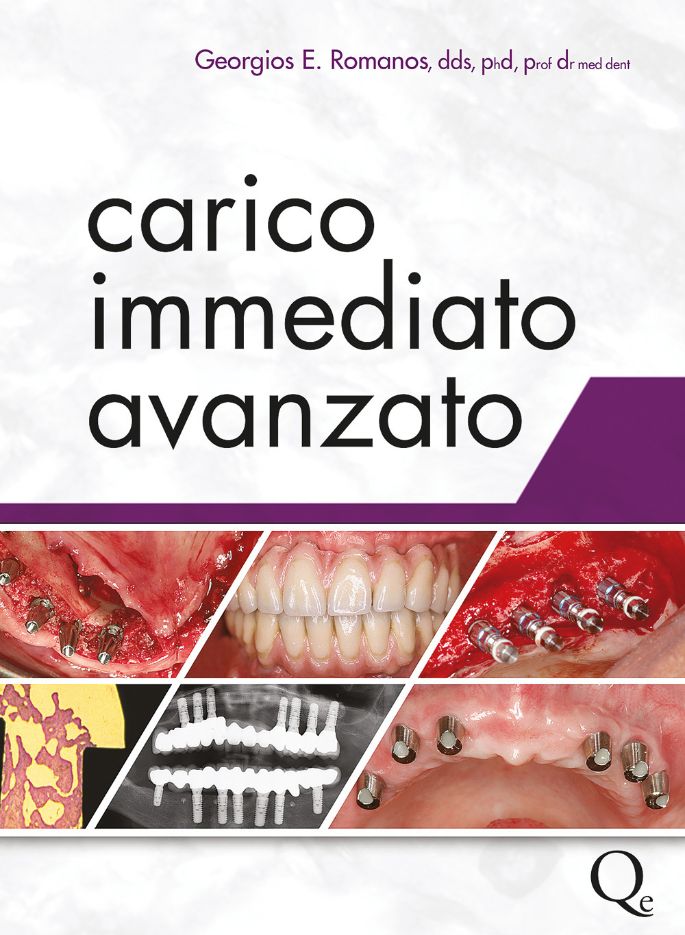 Carico immediato avanzato