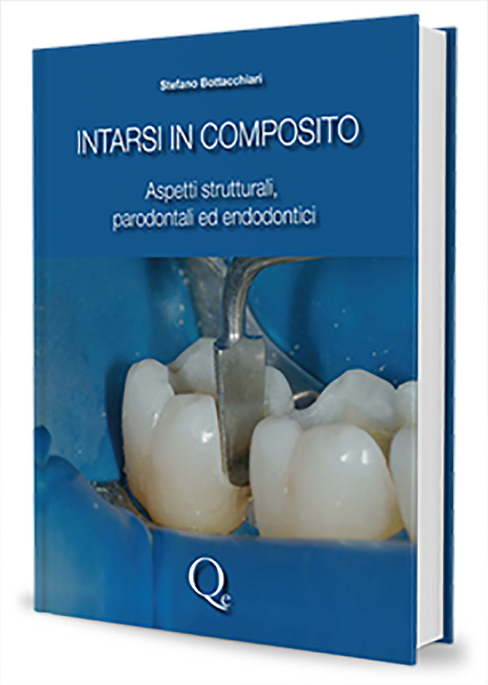 Intarsi in composito. Aspetti strutturali, parodontali ed endodontici