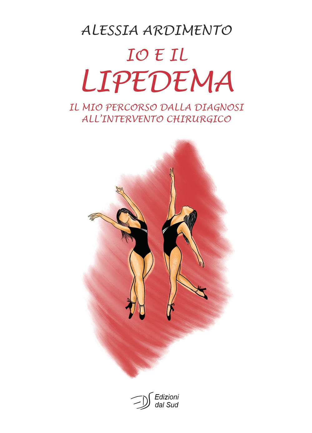 Io e il lipedema. Il mio percorso dalla diagnosi all'intervento chirurgico