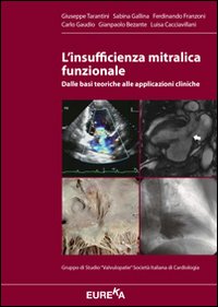 L'insufficienza mitralica funzionale. Dalle basi teoriche alle applicazioni cliniche