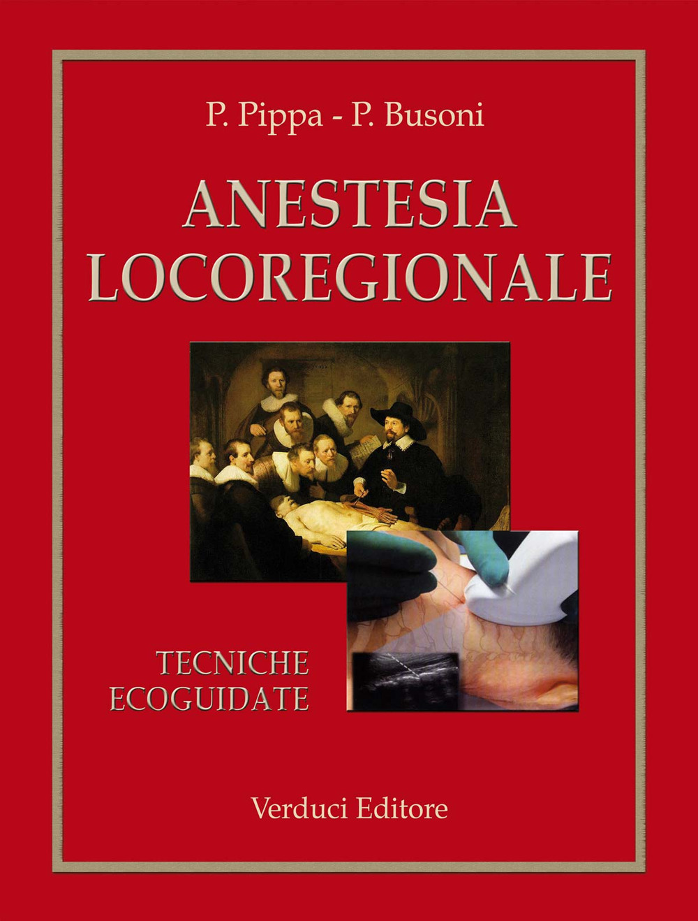 Anestesia locoregionale