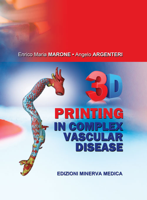 3D printing in complex vascular disease