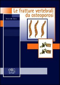 Le fratture vertebrali da osteoporosi