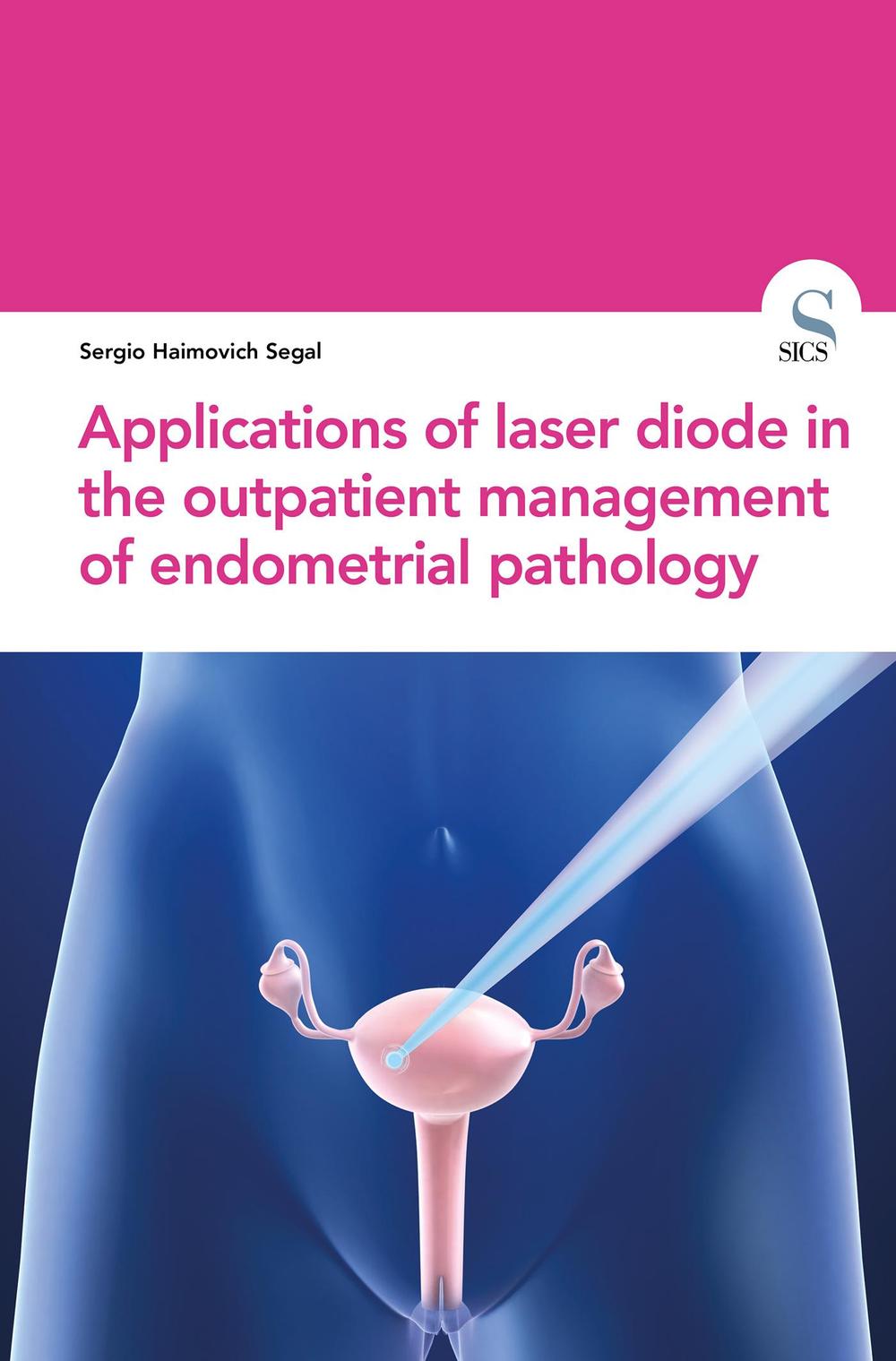 Applications of laser diode in the outpatient management of endometrial pathology