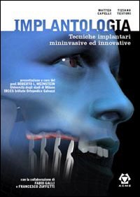 Implantologia. Tecniche implantari mininvasive e innovative