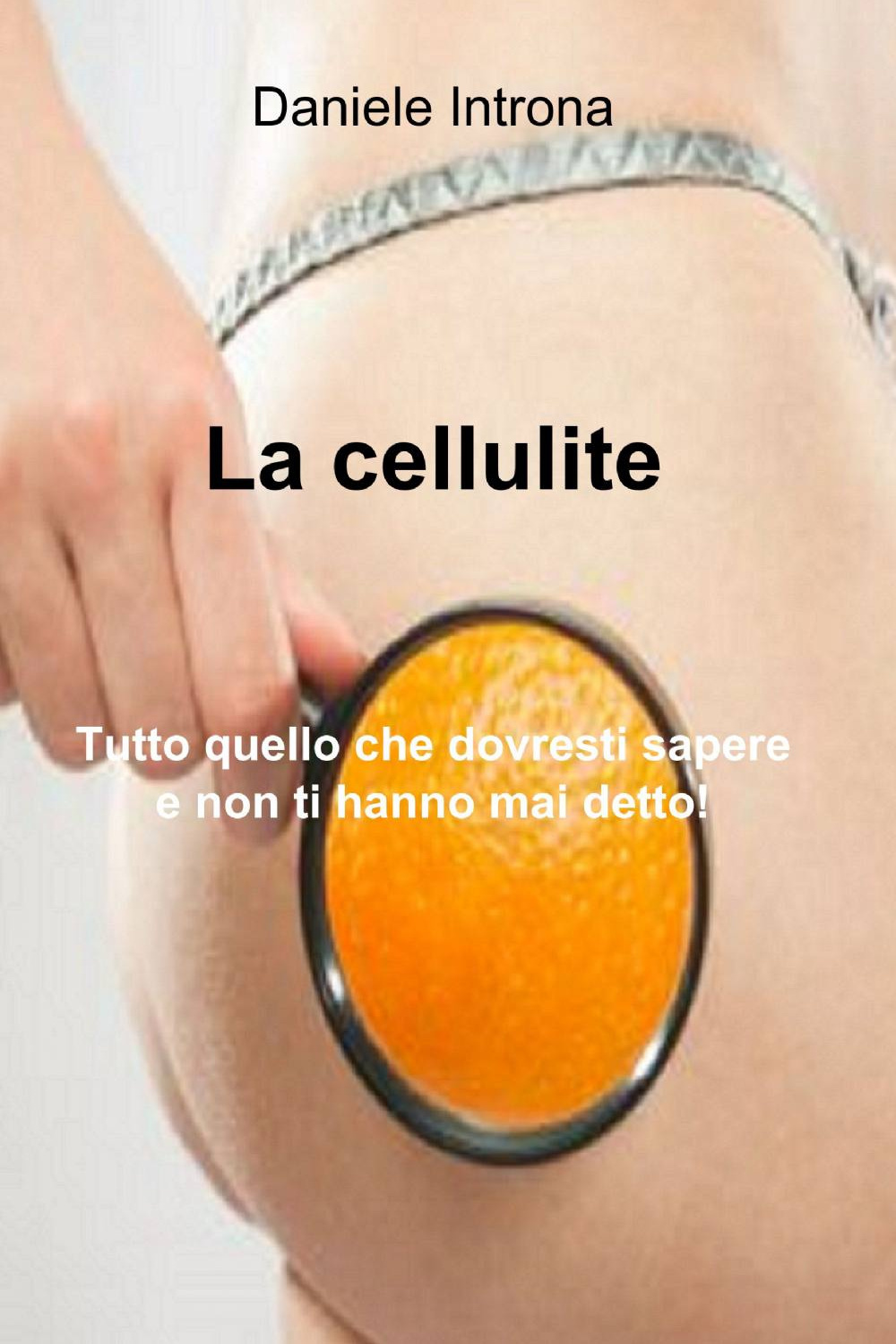 La cellulite