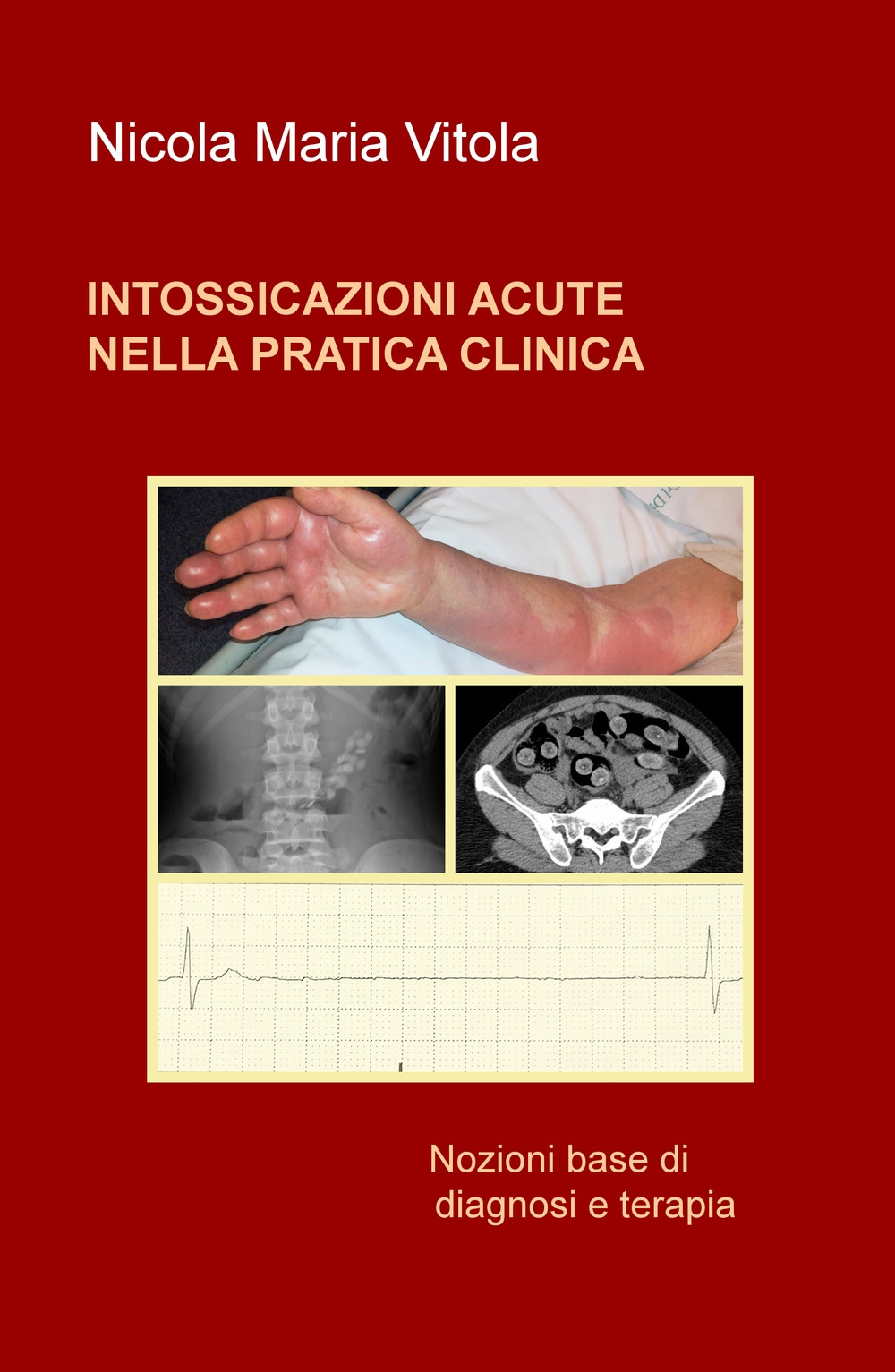 Intossicazioni acute nella pratica clinica. Nozioni base di diagnosi e terapia