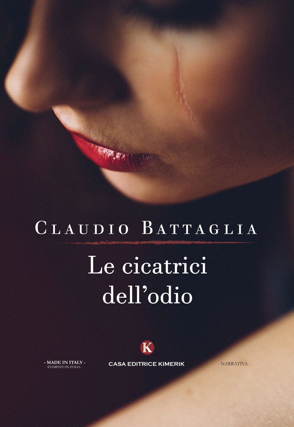 Le cicatrici dell'odio