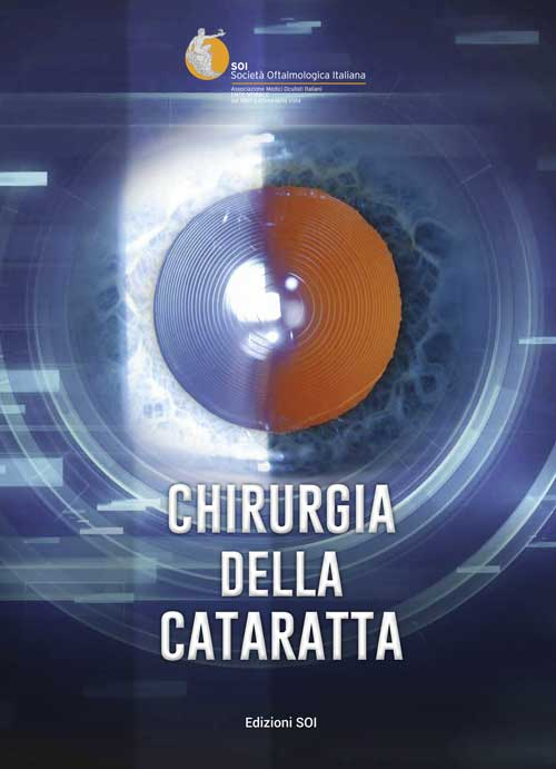 Chirurgia della cataratta. Relazione SOI 2015