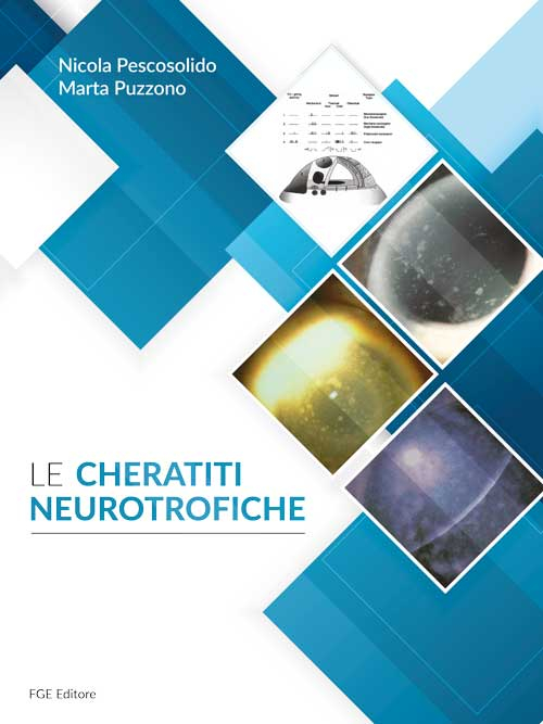 Le cheratiti neurotrofiche