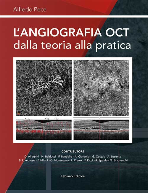 L'angiografia OCT dalla teoria alla pratica