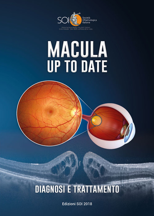 Macula up to date. Diagnosi e trattamento. Ediz. per la scuola