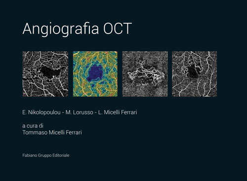 Angiografia oct