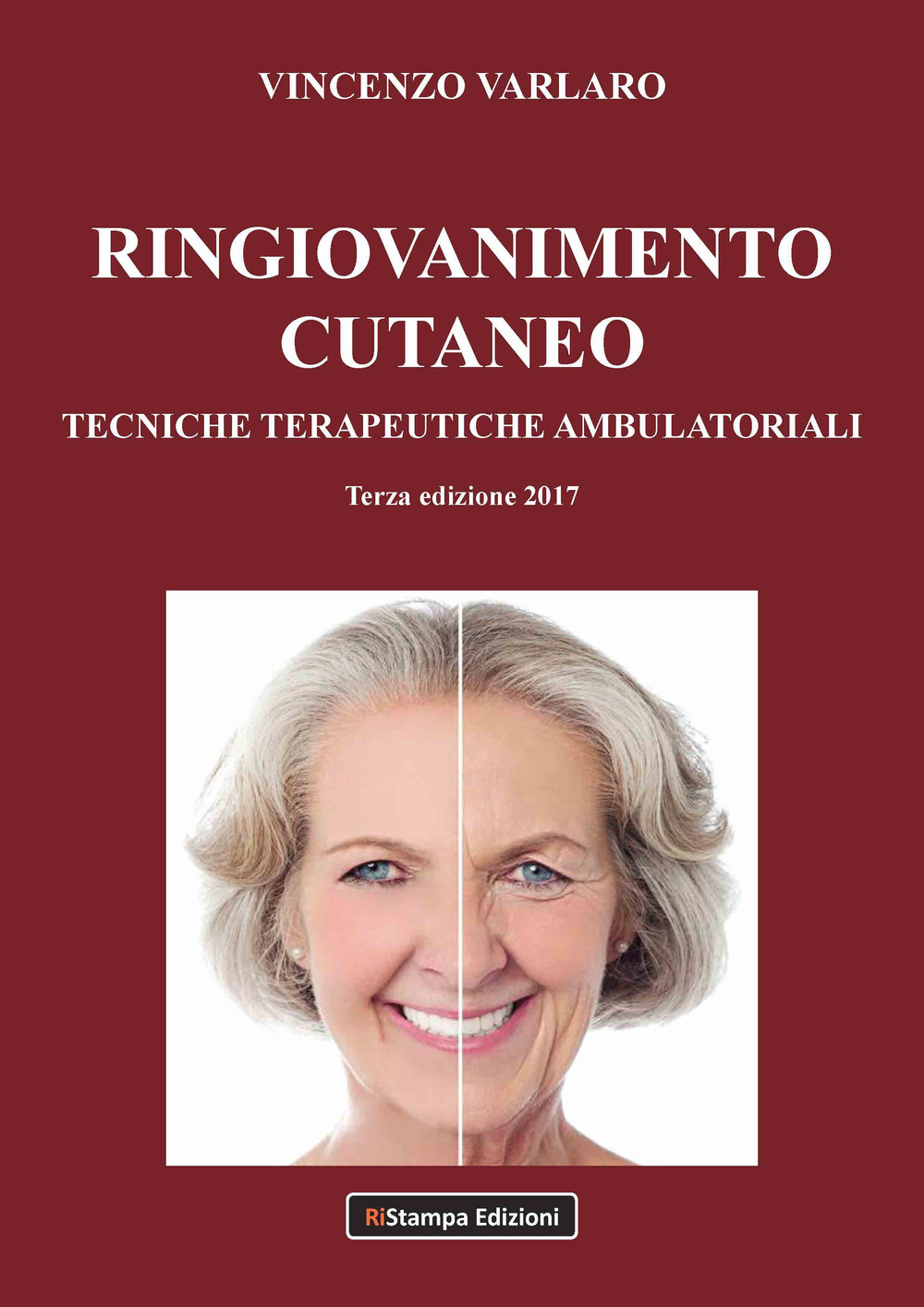 Ringiovanimento cutaneo. Tecniche terapeutiche ambulatoriali