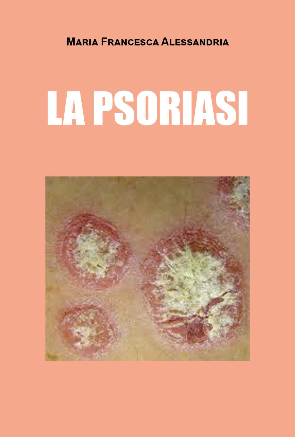 La psoriasi