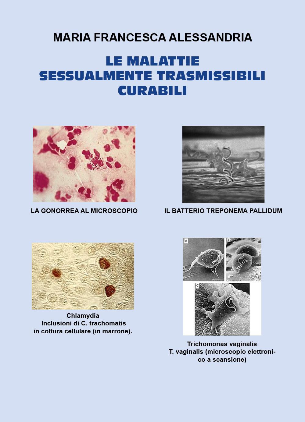 Le malattie sessualmente trasmissibili curabili